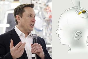 Elon Musk anunţă primul implant al companiei Neuralink în creierul unui om