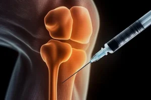 Progres în tratarea osteoporozei - un nou hidrogel crește de până la cinci ori densitatea osoasă