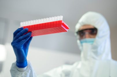virus nipah 3